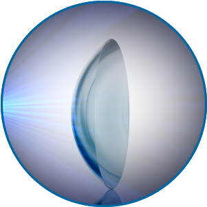 OptiBlue™ light filter per MAX visione